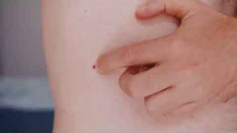 Sole e salute della pelle, i consigli per prevenire melanomi, eritemi e scottature - Edq0z-yJi8U